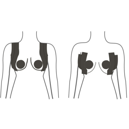 The Invisible Lift: Breast Lift Tape - Image 30